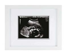 Portafotos para ecografía Pearhead 18x18